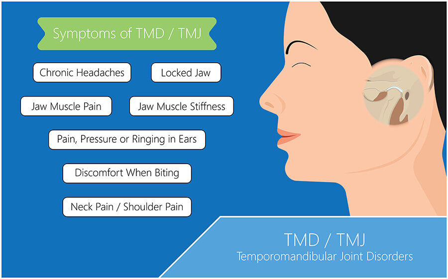 TMJ Symptoms Diagram