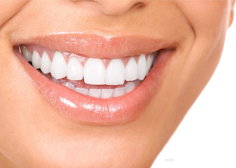 Extreme close up of smiling woman with perfect teeth.