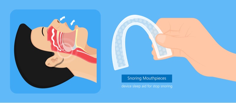 illustration of mouthpiece used to stop snoring.