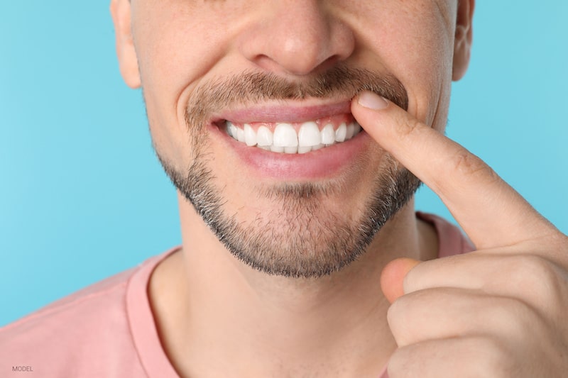 A man shows off his straight, white smile.