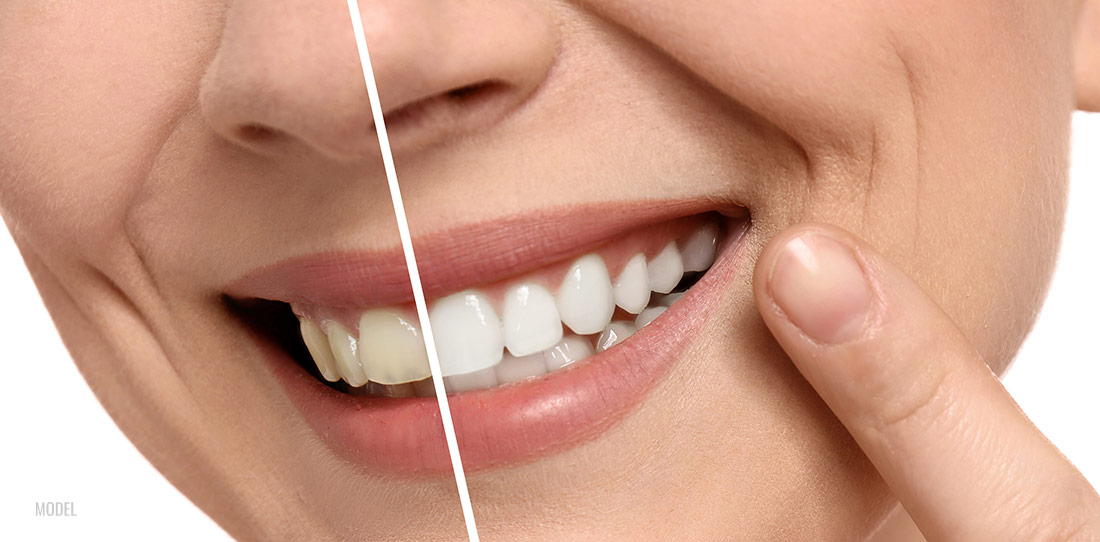 Women close up teeth photo